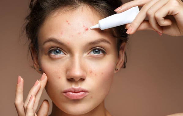 ব্রণের সমস্যা কমাতে যেভাবে ব্যবহার করবেন গোলাপজল