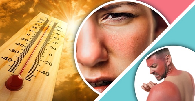 গরম পড়তেই ত্বকে কালচে দাগ? দুর করবেন যেভাবে