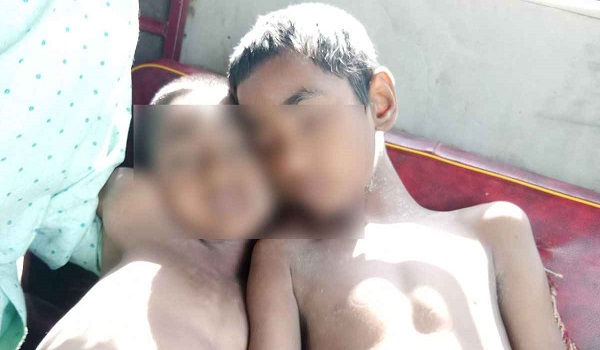 পুকুরের পানিতে ডুবে দুই ভাইয়ের মৃত্যু