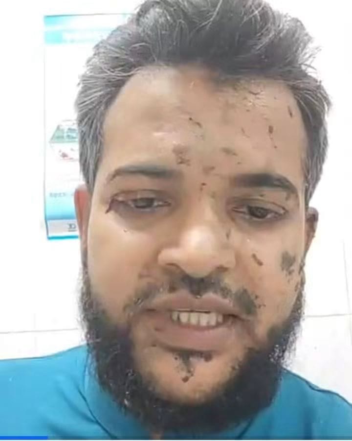 ভান্ডারীয়ায় জামায়াত নেতাদের উপর যুবদলের হামলা